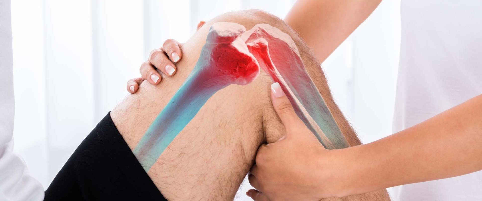 Understanding and Managing ACL Tears
