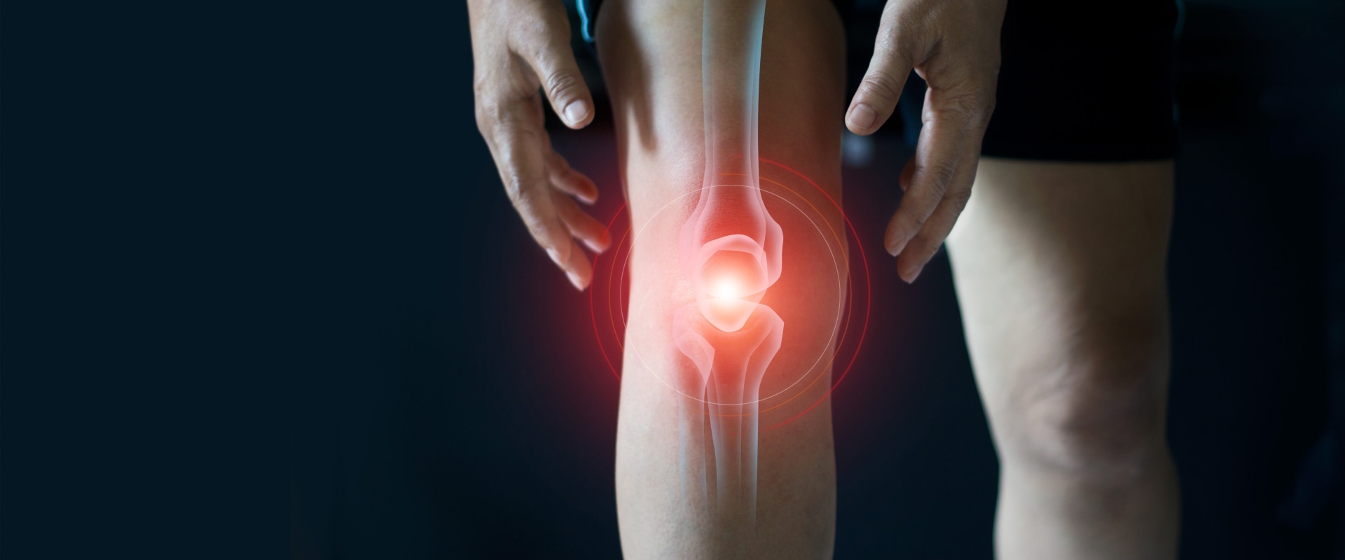 Understanding Medications for Knee Pain Relief
