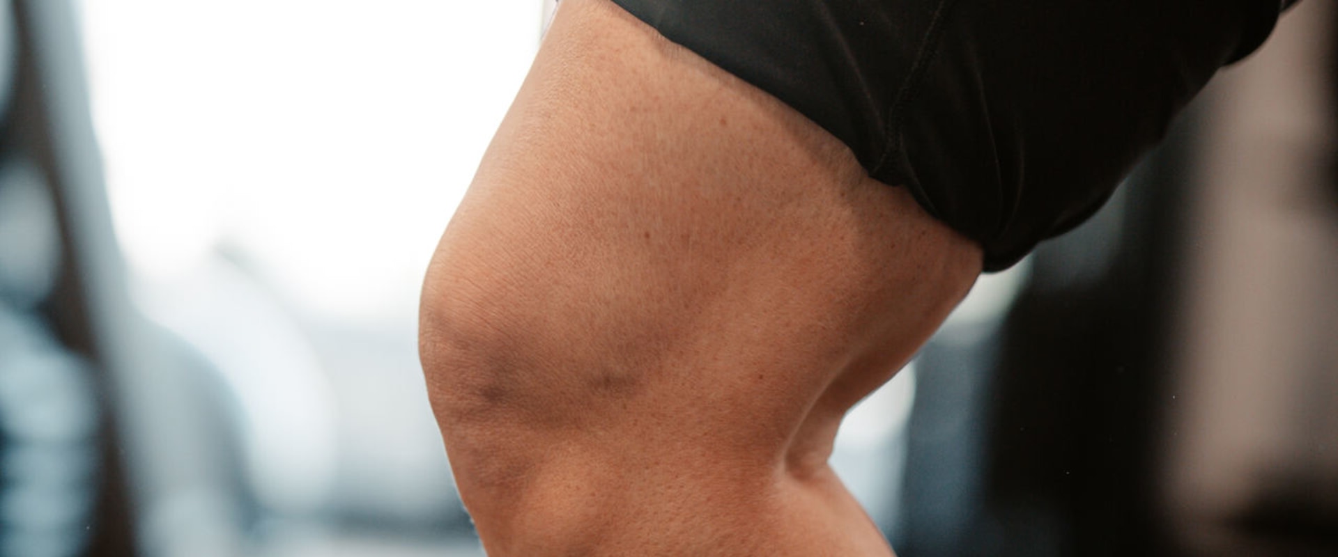 Understanding Osteoarthritis: A Comprehensive Guide to Relieving Knee Pain