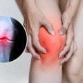 Understanding Rheumatoid Arthritis and Knee Pain