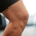 Understanding Osteoarthritis: A Comprehensive Guide to Relieving Knee Pain