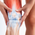 Medication Management for Chronic Knee Pain