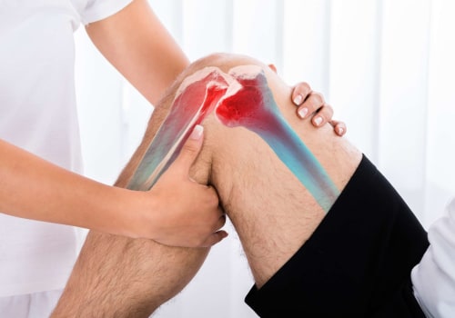 Understanding and Managing ACL Tears