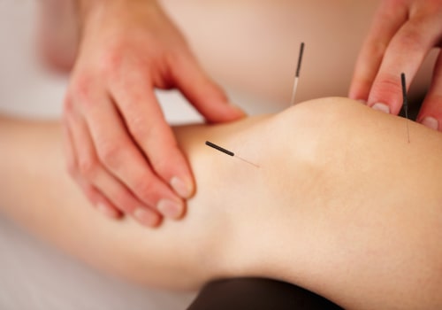 Understanding Acupuncture for Knee Pain Relief