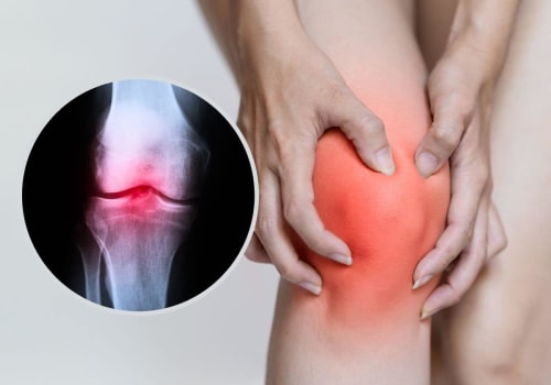 Understanding Rheumatoid Arthritis and Knee Pain