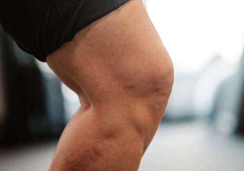 Understanding Osteoarthritis: A Comprehensive Guide to Relieving Knee Pain