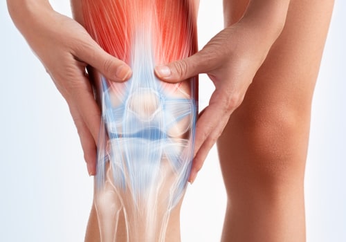 Medication Management for Chronic Knee Pain